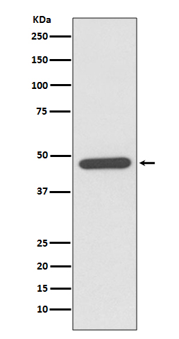 Western blot analysis of NeuroD1 expression in Y79 cell lysate