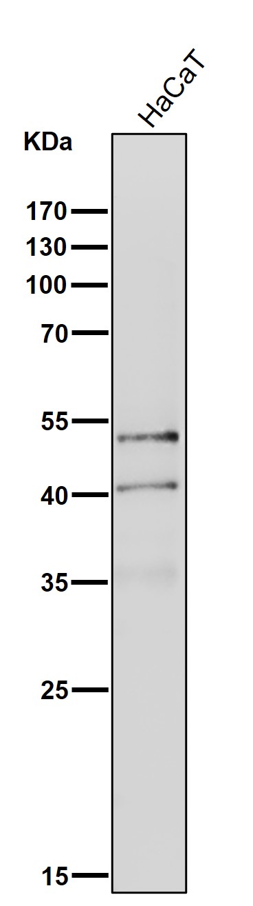 All lanes use the Antibody at 1:1K dilution for 1 hour at room temperature