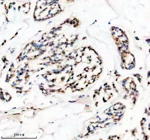 m01043 hmga1 primary antibodies ihc testing 1