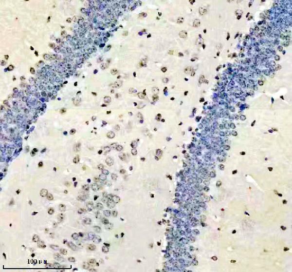 m01043 hmga1 primary antibodies ihc testing 10