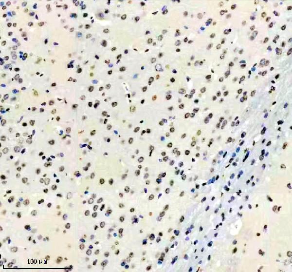 m01043 hmga1 primary antibodies ihc testing 11