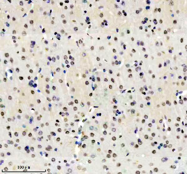 m01043 hmga1 primary antibodies ihc testing 12
