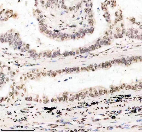 m01043 hmga1 primary antibodies ihc testing 2