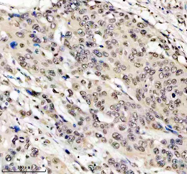 m01043 hmga1 primary antibodies ihc testing 3