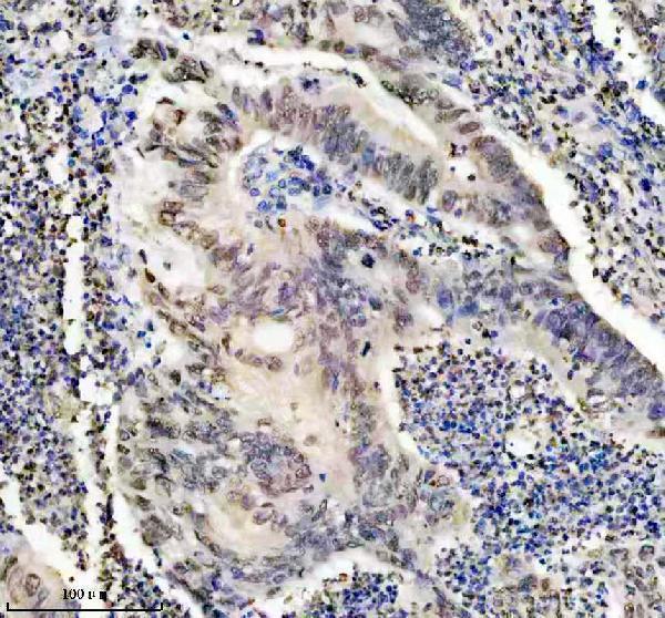 m01043 hmga1 primary antibodies ihc testing 4