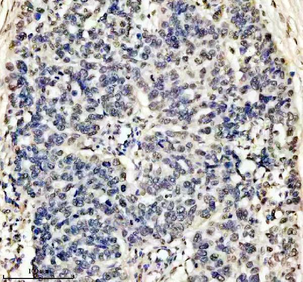 m01043 hmga1 primary antibodies ihc testing 5