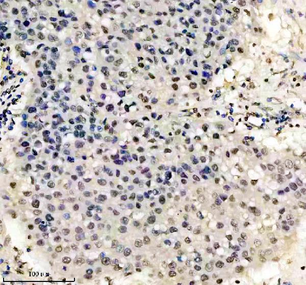 m01043 hmga1 primary antibodies ihc testing 6
