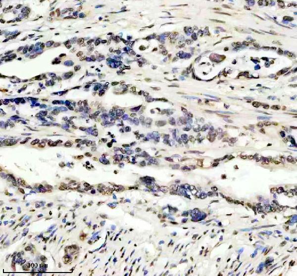 m01043 hmga1 primary antibodies ihc testing 7