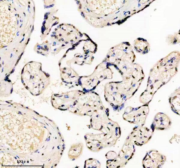 m01043 hmga1 primary antibodies ihc testing 8