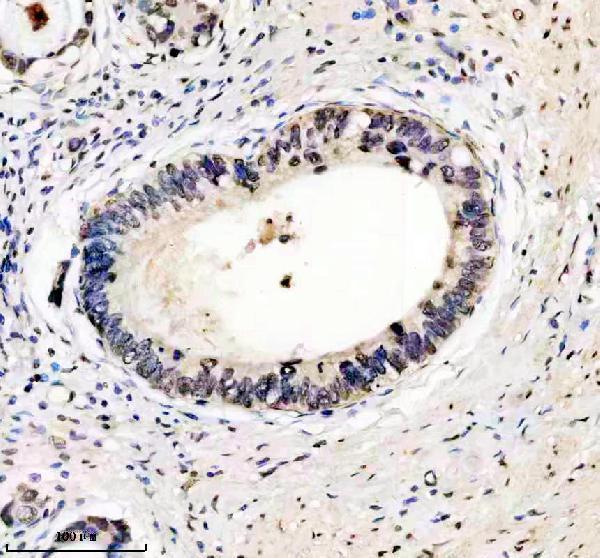 m01043 hmga1 primary antibodies ihc testing 9