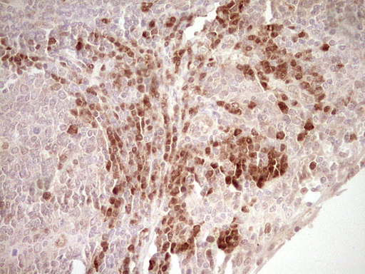Immunohistochemical staining of paraffin-embedded Human tonsil within the normal limits using anti-KLF2 mouse monoclonal antibody