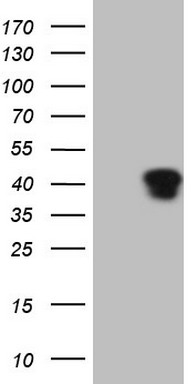 HEK293T cells were transfected with the pCMV6-ENTRY control (Left lane) or pCMV6-ENTRY KLF2 (Right lane) cDNA for 48 hrs and lysed