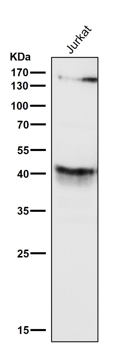 All lanes use the Antibody at 1:3K dilution for 1 hour at room temperature
