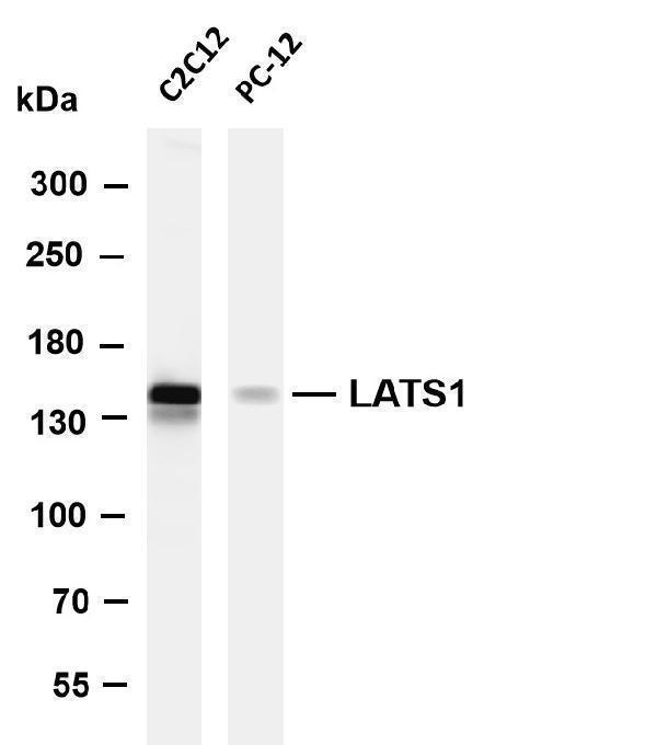 Various whole cell lysates were separated by 4-8% SDS-PAGE, and the membrane was blotted with anti-LATS1 antibody