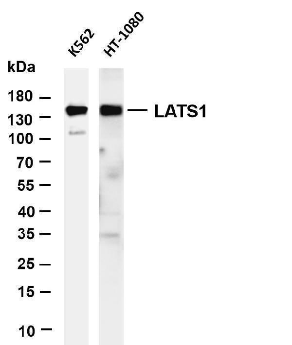 Various whole cell lysates were separated by 4-20% SDS-PAGE, and the membrane was blotted with anti-LATS1 antibody