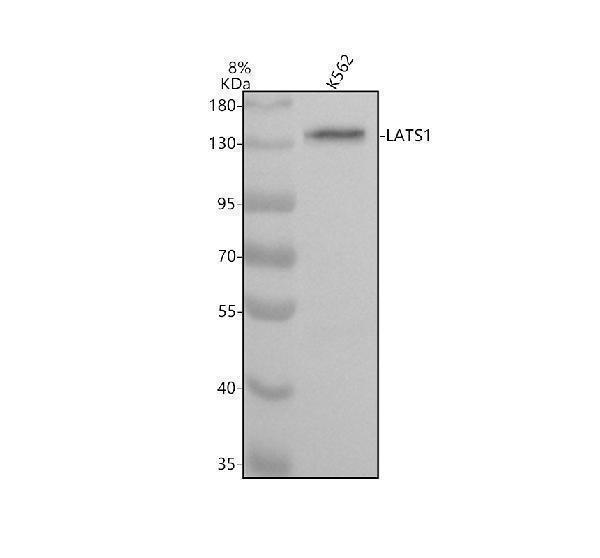 Western blot analysis of LATS1 using anti-LATS1 antibody (M01051)