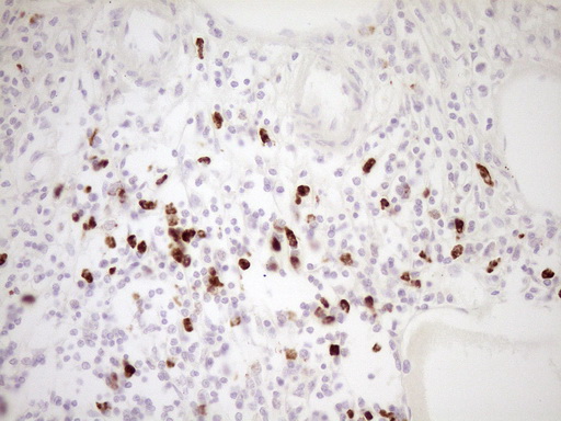 m01052 anti tfpi mouse monoclonal antibody clone id oti5h5 ihc testing 4