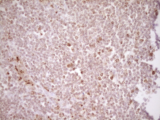 m01052 anti tfpi mouse monoclonal antibody clone id oti5h5 ihc testing 5