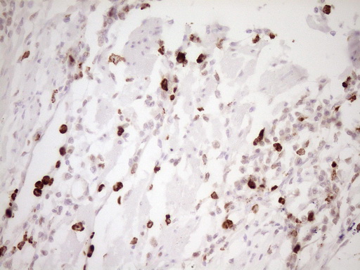 m01052 anti tfpi mouse monoclonal antibody clone id oti5h5 ihc testing 7