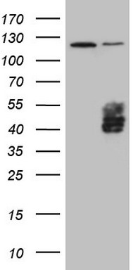 HEK293T cells were transfected with the pCMV6-ENTRY control (Left lane) or pCMV6-ENTRY TFPI (Right lane) cDNA for 48 hrs and lysed
