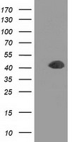 HEK293T cells were transfected with the pCMV6-ENTRY control (Left lane) or pCMV6-ENTRY DCX (Right lane) cDNA for 48 hrs and lysed
