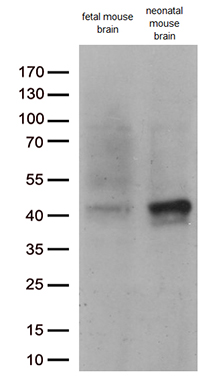 Western blot analysis of extracts (35ug) from 2 tissues by using anti-DCX monoclonal antibody (1:250)