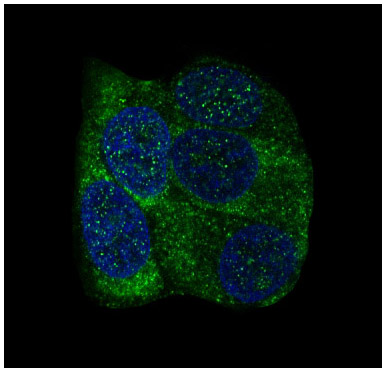 m01054 ybx1 primary antibodies if testing 3