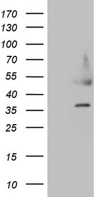 HEK293T cells were transfected with the pCMV6-ENTRY control (Left lane) or pCMV6-ENTRY HDGF (Right lane) cDNA for 48 hrs and lysed