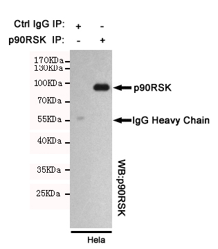Immunoprecipitation analysis of Hela cell lysates using p90RSK mouse mAb