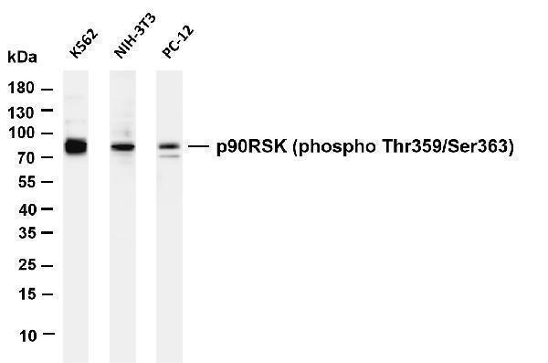 m01058 3 rps6ka1 primary antibodies wb testing 4