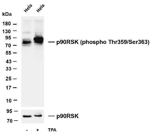 m01058 3 rps6ka1 primary antibodies wb testing 5