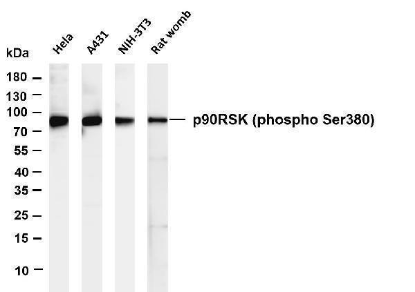 Various whole cell lysates were separated by 4-20% SDS-PAGE, and the membrane was blotted with anti-p90RSK (phospho Ser380) antibody