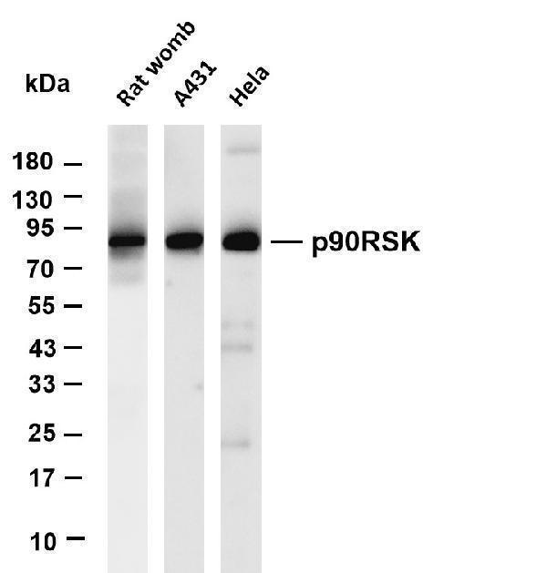 m01058 5 rps6ka1 primary antibodies wb testing 1