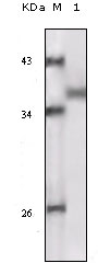 Western Blot analysis using Rsk-1 Monoclonal Antibody against truncated Rsk-1 recombinant protein