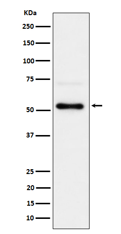 Western blot analysis of Phospho-Chk1 (S280) expression in 293T treated with Calyculin A cell lysate