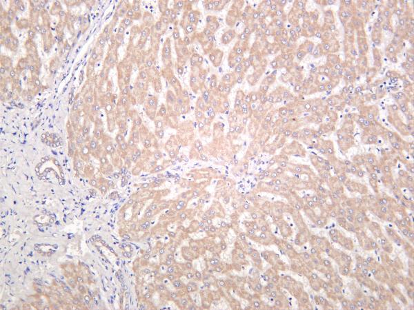 Human liver was stained with anti-SIRT3 rabbit antibody