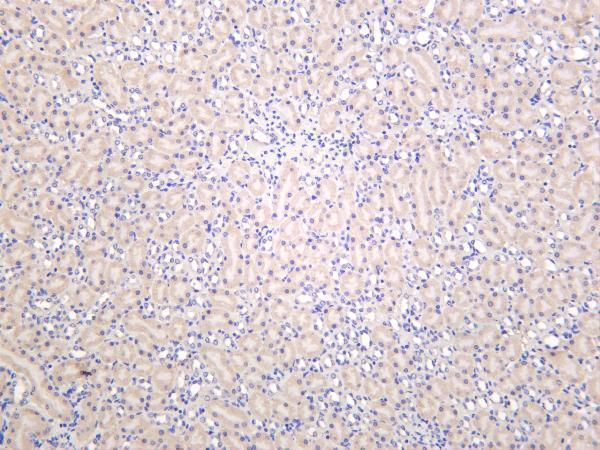 m01061 1 sirt3 primary antibodies ihc testing 4