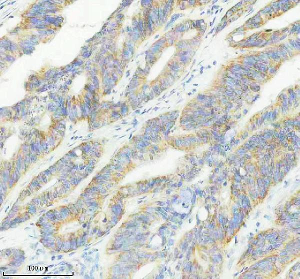 IHC analysis of SIRT3 using anti-SIRT3 antibody (M01061)