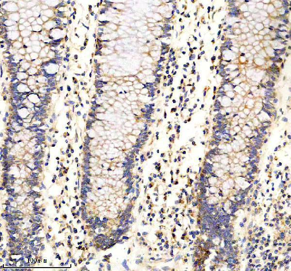 m01061 sirt3 primary antibodies ihc testing 2