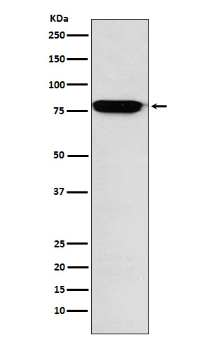 Western blot analysis of RANK expression in Human fetal liver lysate