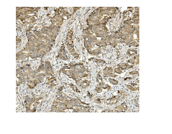 m01065 methylmalonyl coenzyme a primary antibodies ihc testing 2