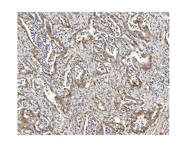 m01065 methylmalonyl coenzyme a primary antibodies ihc testing 3