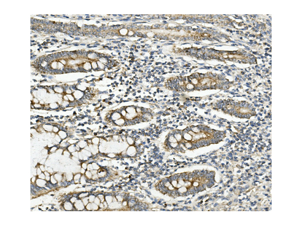 m01065 methylmalonyl coenzyme a primary antibodies ihc testing 4