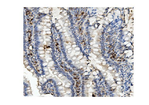 m01065 methylmalonyl coenzyme a primary antibodies ihc testing 5