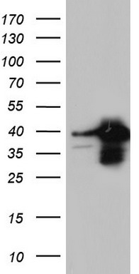 HEK293T cells were transfected with the pCMV6-ENTRY control (Left lane) or pCMV6-ENTRY XRCC3 (Right lane) cDNA for 48 hrs and lysed