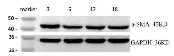 Western blot analysis of ACTA2 using anti-ACTA2 antibody (M01072-1)