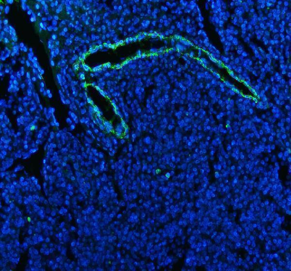 m01072 3 alpha sma primary antibodies if testing 1