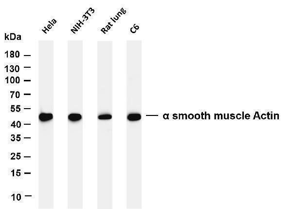 Various whole cell lysates were separated by 4-20% SDS-PAGE, and the membrane was blotted with anti-α smooth muscle Actin antibody