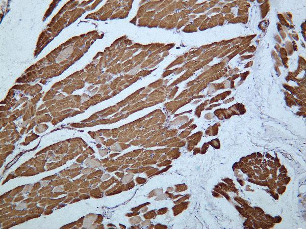 Human skeletal muscle was stained with Anti-Actin pan rabbit antibody