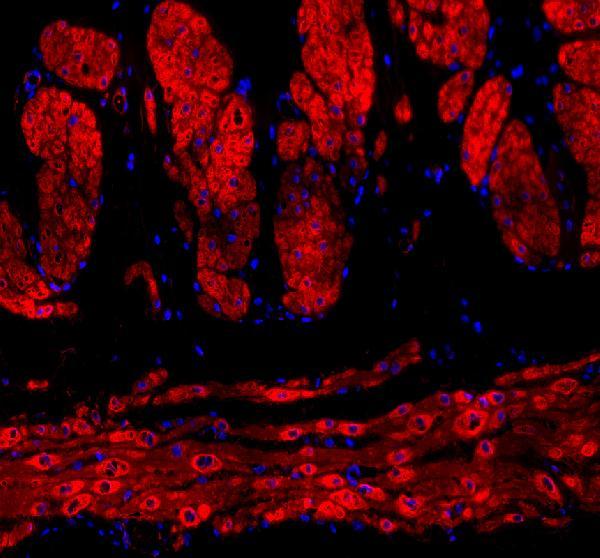 IF analysis of Alpha-Smooth Muscle Actin using anti-Alpha-Smooth Muscle Actin antibody (M01072-7)